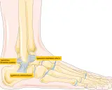 Illustration av fotens ligament. Ligamentum fibulotalare anterior, posterior och ligamentum calcaneofibulare visas. Kan vara bra att veta om man trampar snett.